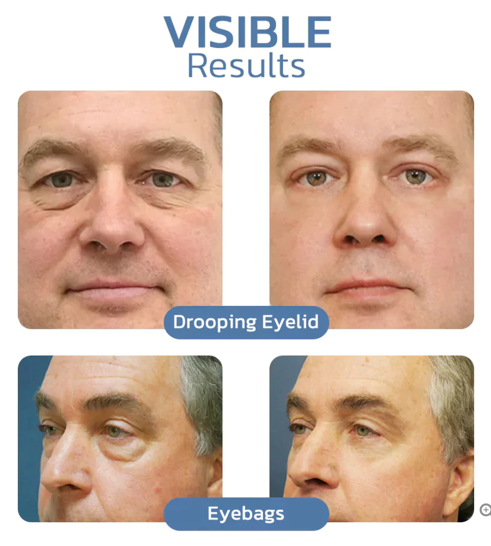 đ„Imported Anti Ageing & Dark Circles Serum For Both Men & Womenđ„Dermatologist Recommended