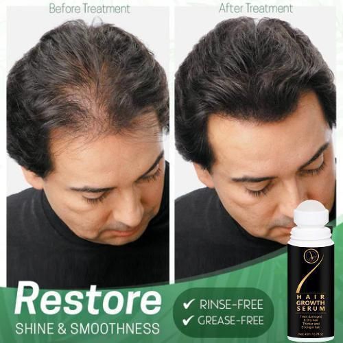 HAIR GROWTH ORGANIC SERUM (🔥50% OFF TODAY🔥) (4.9 ⭐⭐⭐⭐⭐ 89,492 REVIEWS)