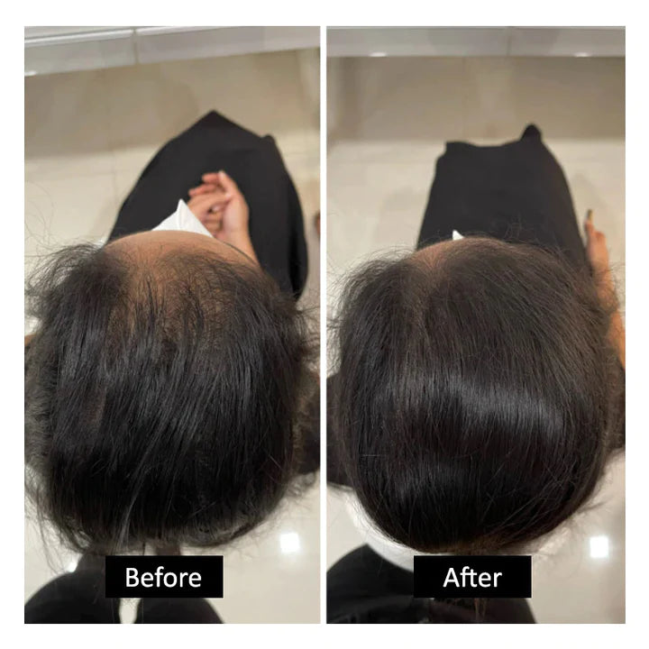 🔥Instant Root Cover Up For Perfect Hair Color 🔥Buy 1 Get 1 Free | Only For Today🔥