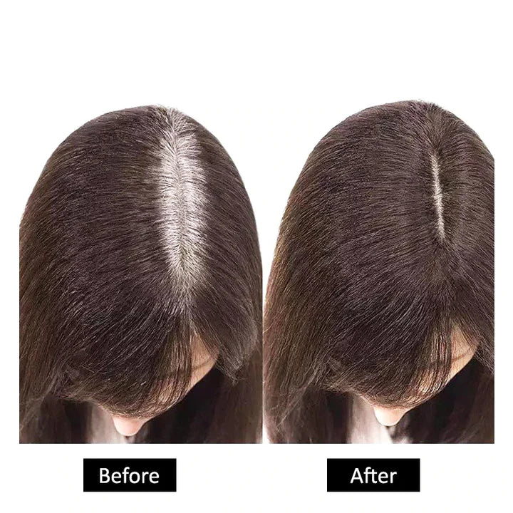 🔥Instant Root Cover Up For Perfect Hair Color 🔥Buy 1 Get 1 Free | Only For Today🔥
