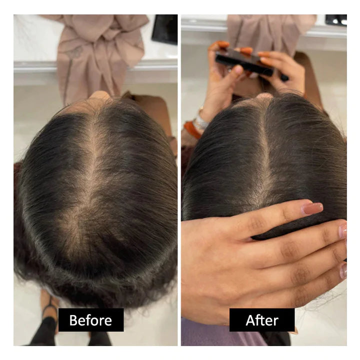 🔥Instant Root Cover Up For Perfect Hair Color 🔥Buy 1 Get 1 Free | Only For Today🔥