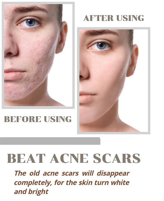 ⭐⭐⭐⭐⭐ (4.9/5)  💖100% ORIGINAL Niacinamide Facial Essence💖